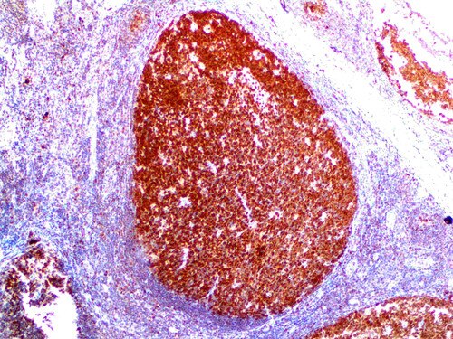 IHC of BOB.1 on an FFPE Tonsil Tissue